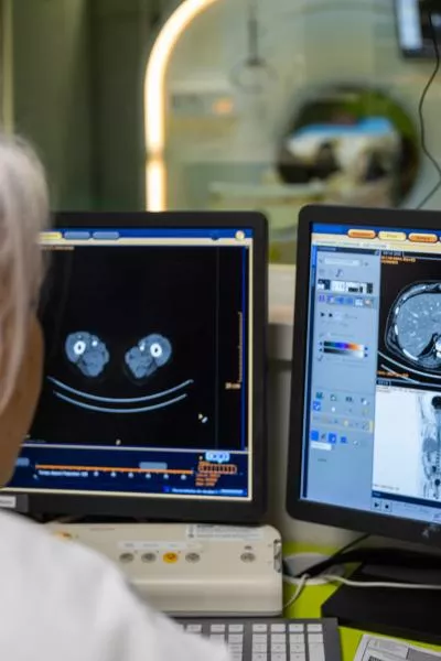Imagerie IRM Analyse d'image
